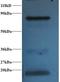 Hemoglobin Subunit Alpha 2 antibody, LS-C211256, Lifespan Biosciences, Western Blot image 