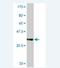 Ubiquitin Conjugating Enzyme E2 D4 (Putative) antibody, H00051619-M01, Novus Biologicals, Western Blot image 