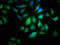 Arachidonate 15-Lipoxygenase Type B antibody, LS-C369220, Lifespan Biosciences, Immunofluorescence image 