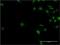 Activity Dependent Neuroprotector Homeobox antibody, H00023394-M02, Novus Biologicals, Immunocytochemistry image 
