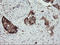 TPD52 Like 3 antibody, LS-C174067, Lifespan Biosciences, Immunohistochemistry paraffin image 