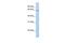 Angiopoietin Like 2 antibody, PA5-44219, Invitrogen Antibodies, Western Blot image 