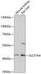 Glucose-6-phosphate translocase antibody, 15-605, ProSci, Western Blot image 