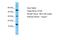 Beta-synuclein antibody, A30307, Boster Biological Technology, Western Blot image 