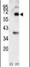 Bone Morphogenetic Protein 3 antibody, PA5-11716, Invitrogen Antibodies, Western Blot image 