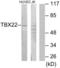 T-Box 22 antibody, LS-C119345, Lifespan Biosciences, Western Blot image 