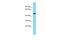 Transmembrane Protein 246 antibody, A18051, Boster Biological Technology, Western Blot image 