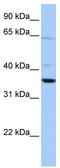 Calponin 2 antibody, TA340047, Origene, Western Blot image 