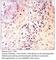 C-C Motif Chemokine Receptor 3 antibody, CCR3-301AP, FabGennix, Immunohistochemistry paraffin image 