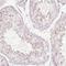 Pyridoxal Dependent Decarboxylase Domain Containing 1 antibody, NBP2-47336, Novus Biologicals, Immunohistochemistry paraffin image 