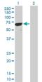 Protein Phosphatase 1 Regulatory Subunit 16B antibody, H00026051-D01P, Novus Biologicals, Western Blot image 