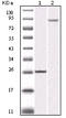 Inhibitor Of Nuclear Factor Kappa B Kinase Subunit Beta antibody, STJ98164, St John