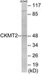 Creatine Kinase, Mitochondrial 2 antibody, EKC1681, Boster Biological Technology, Western Blot image 