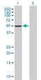 Zinc Finger Protein 71 antibody, H00058491-D01P, Novus Biologicals, Western Blot image 
