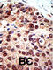 Protein Arginine Methyltransferase 3 antibody, 55-024, ProSci, Immunohistochemistry paraffin image 