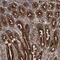 Isoleucyl-TRNA Synthetase 2, Mitochondrial antibody, PA5-55117, Invitrogen Antibodies, Immunohistochemistry paraffin image 