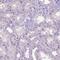 Solute Carrier Family 35 Member C1 antibody, PA5-64146, Invitrogen Antibodies, Immunohistochemistry paraffin image 