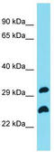 Shiftless Antiviral Inhibitor Of Ribosomal Frameshifting antibody, TA330679, Origene, Western Blot image 