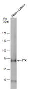 Spleen Associated Tyrosine Kinase antibody, GTX100748, GeneTex, Western Blot image 