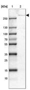Ubiquitin Specific Peptidase 24 antibody, NBP1-82942, Novus Biologicals, Western Blot image 