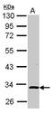 NGG1 Interacting Factor 3 Like 1 antibody, PA5-30791, Invitrogen Antibodies, Western Blot image 