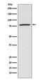 Arachidonate 5-Lipoxygenase antibody, M00847, Boster Biological Technology, Western Blot image 