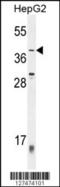 Zinc Finger Protein 763 antibody, 55-262, ProSci, Western Blot image 