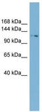 Tetratricopeptide Repeat Domain 17 antibody, TA344890, Origene, Western Blot image 