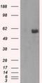 AKT Serine/Threonine Kinase 2 antibody, NBP2-02231, Novus Biologicals, Western Blot image 