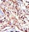 SRC-1 antibody, A00107, Boster Biological Technology, Immunohistochemistry paraffin image 
