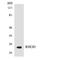 Ras Homolog Family Member D antibody, LS-C200601, Lifespan Biosciences, Western Blot image 