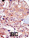 Transient Receptor Potential Cation Channel Subfamily M Member 7 antibody, 63-367, ProSci, Immunohistochemistry paraffin image 