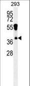 Rhox Homeobox Family Member 2 antibody, LS-C162599, Lifespan Biosciences, Western Blot image 