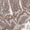 Mesoderm Development LRP Chaperone antibody, PA5-58781, Invitrogen Antibodies, Immunohistochemistry paraffin image 