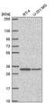 Transmembrane Protein 81 antibody, PA5-65728, Invitrogen Antibodies, Western Blot image 