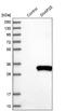 Synaptosome Associated Protein 25 antibody, NBP1-88769, Novus Biologicals, Western Blot image 