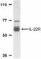 Interleukin 22 antibody, NBP2-31215, Novus Biologicals, Western Blot image 