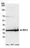 Protein MIS12 homolog antibody, A300-776A, Bethyl Labs, Western Blot image 