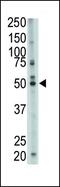 Farnesyl-Diphosphate Farnesyltransferase 1 antibody, PA5-12163, Invitrogen Antibodies, Western Blot image 