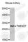 Collectrin, Amino Acid Transport Regulator antibody, A3471, ABclonal Technology, Western Blot image 