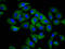 Rho Family GTPase 1 antibody, LS-C682318, Lifespan Biosciences, Immunofluorescence image 