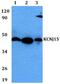 Potassium Voltage-Gated Channel Subfamily J Member 15 antibody, PA5-75759, Invitrogen Antibodies, Western Blot image 