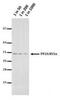 Protein Phosphatase 2 Catalytic Subunit Alpha antibody, MA5-18064, Invitrogen Antibodies, Western Blot image 