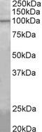 Cytosolic carboxypeptidase-like protein 5 antibody, LS-C154862, Lifespan Biosciences, Western Blot image 