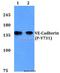 CD144 antibody, A02632Y731, Boster Biological Technology, Western Blot image 