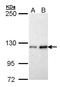 Fibulin 2 antibody, LS-C185686, Lifespan Biosciences, Western Blot image 