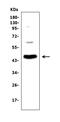 Adenosine Deaminase antibody, A00866-2, Boster Biological Technology, Western Blot image 