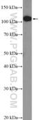 DENN Domain Containing 1A antibody, 25658-1-AP, Proteintech Group, Western Blot image 