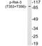 Ribosomal Protein S6 Kinase A2 antibody, LS-C291524, Lifespan Biosciences, Western Blot image 