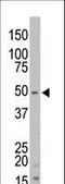 Serine/threonine-protein kinase 35 antibody, LS-C100784, Lifespan Biosciences, Western Blot image 